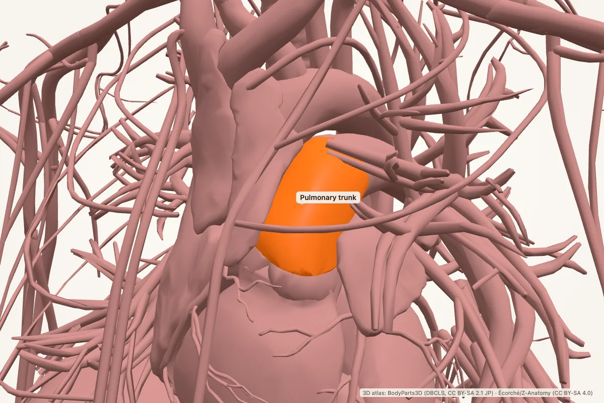 Pulmonary trunk highlighted in a 3D model of the human body