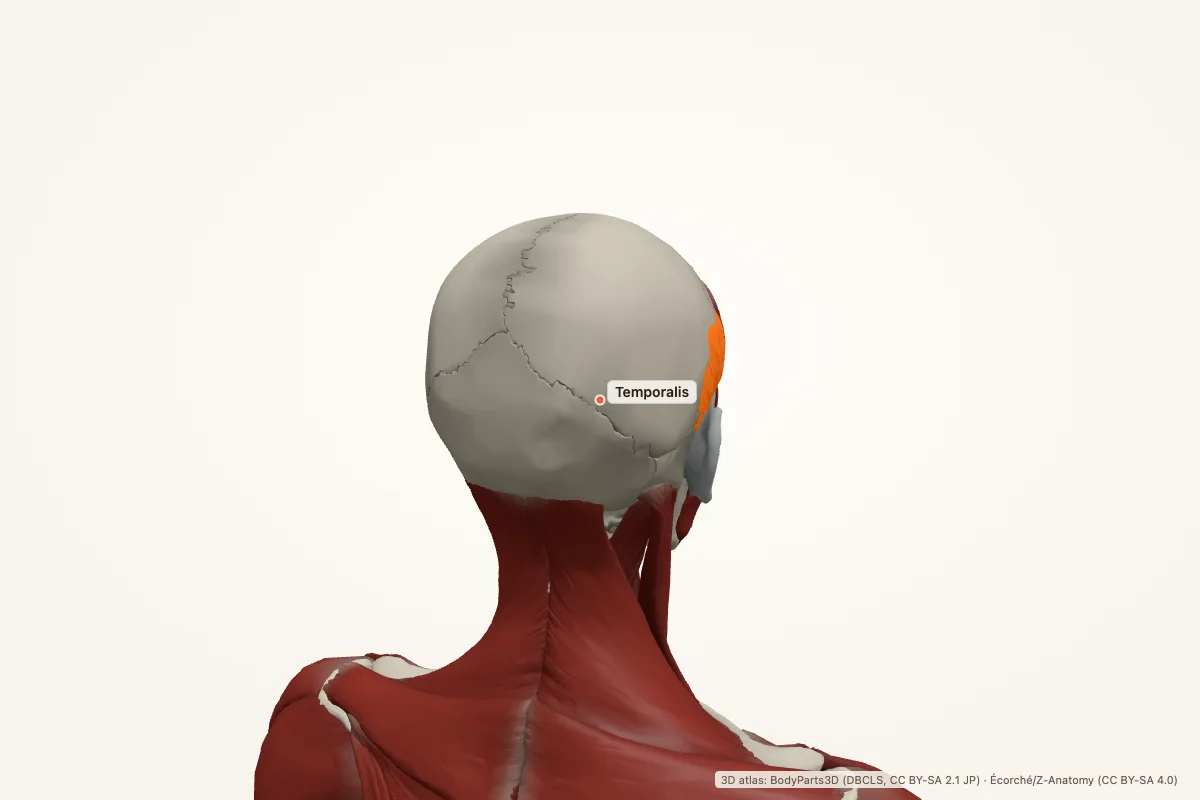 Temporalis highlighted in a 3D model of the human body